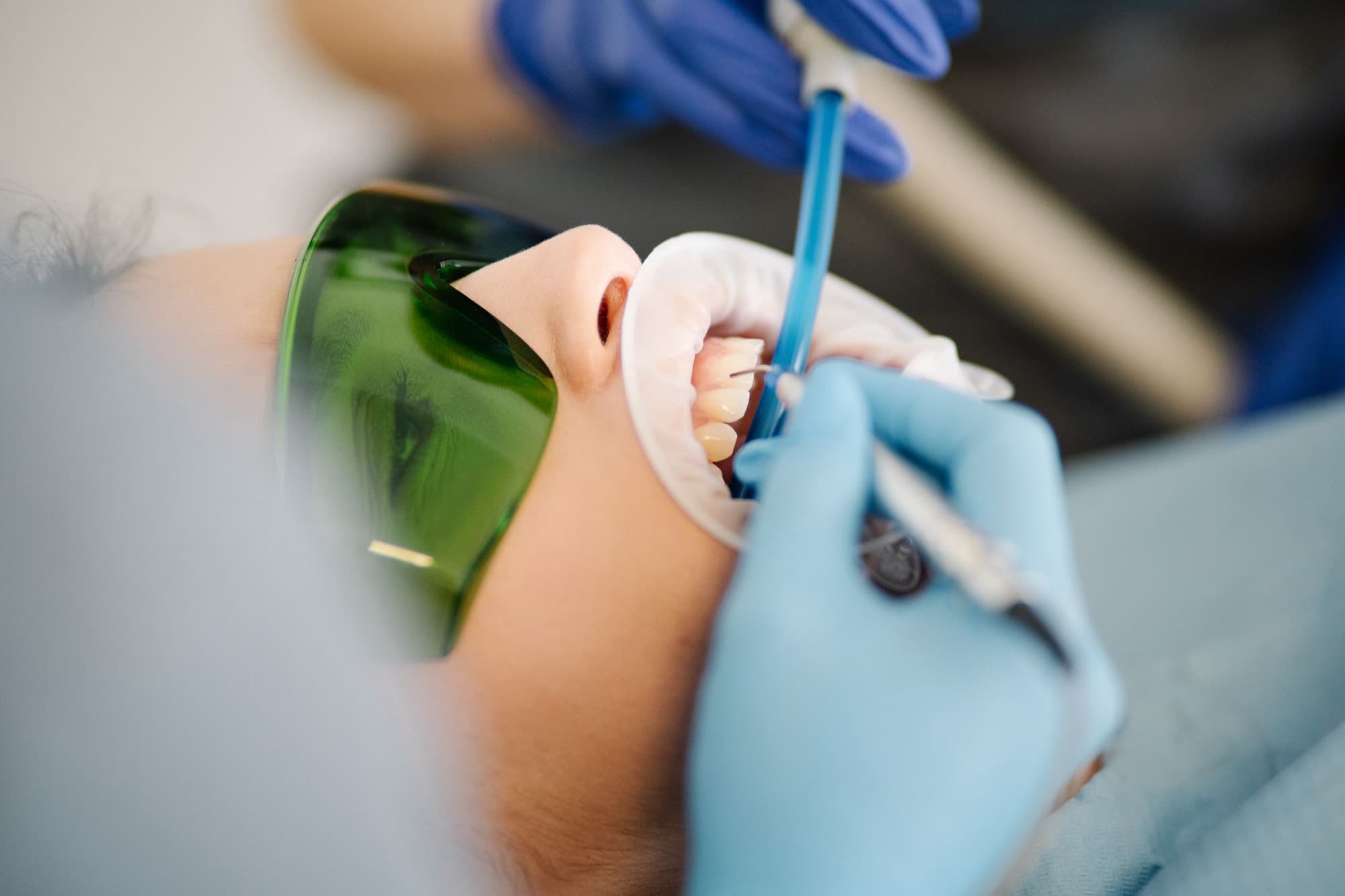 Igienizare profesională la clinica Confident Dr. Talpoș din Timișoara